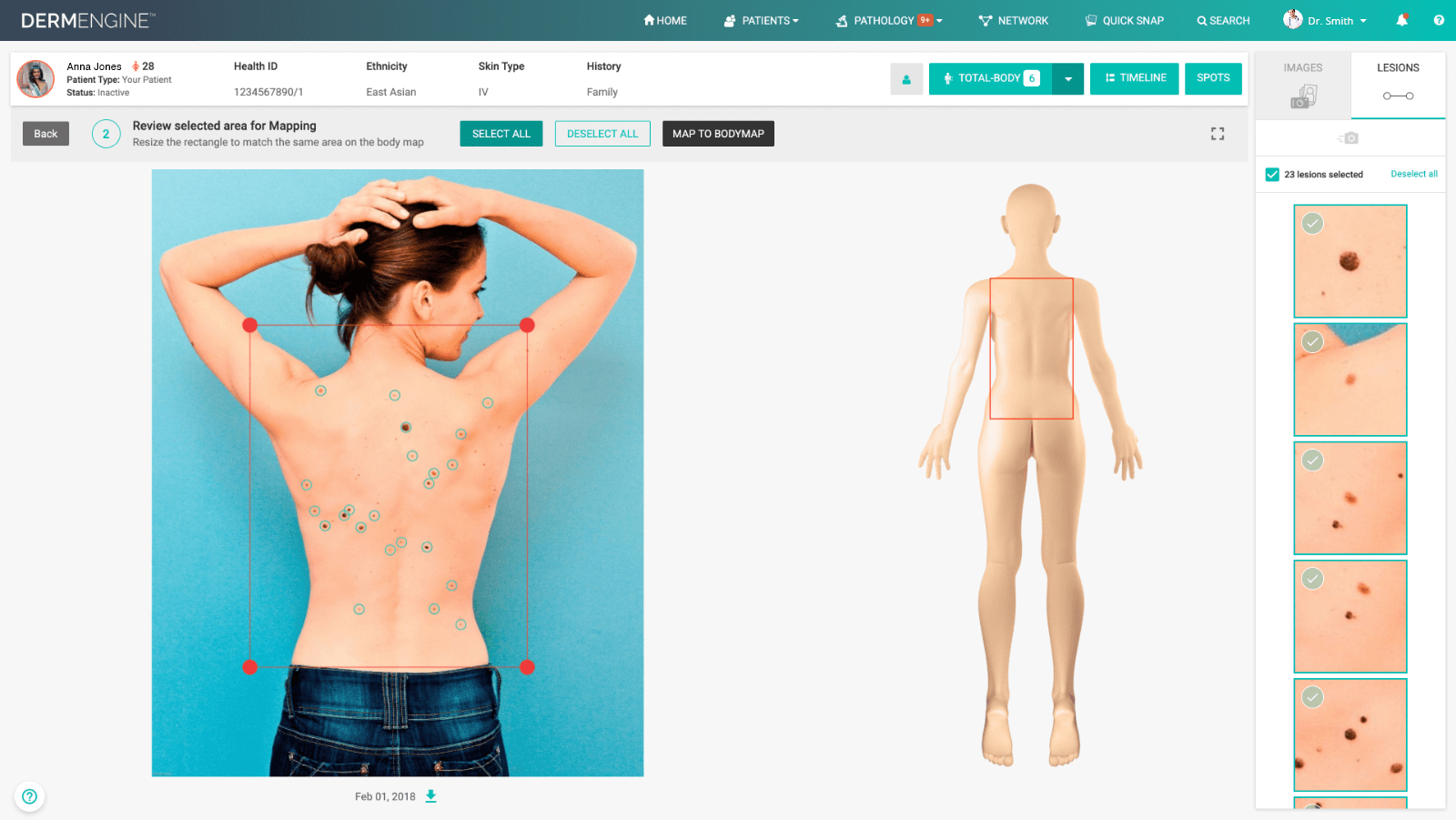 dermengine-total-body-photography